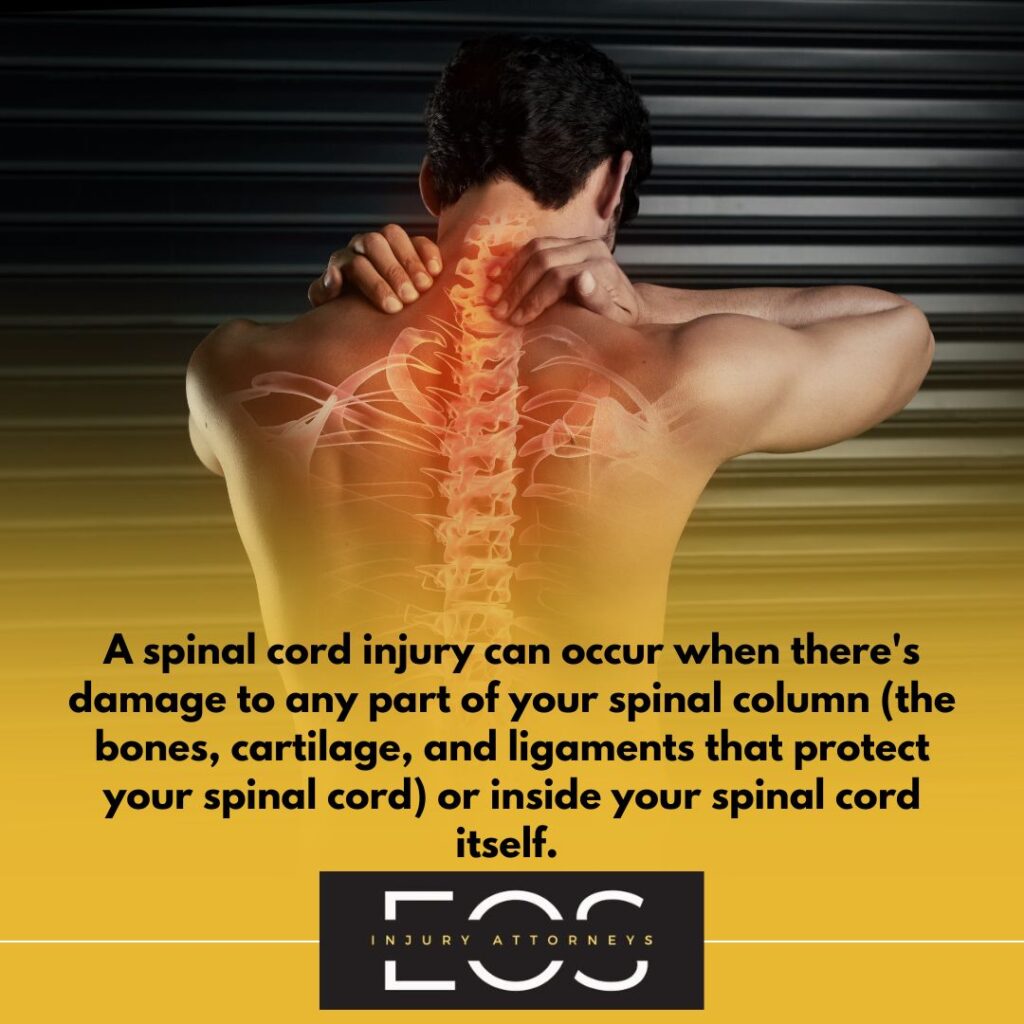 Spinal Cord Injury Lawyer | Eos Law | Spinal Cord Injury Lawyer Near Me