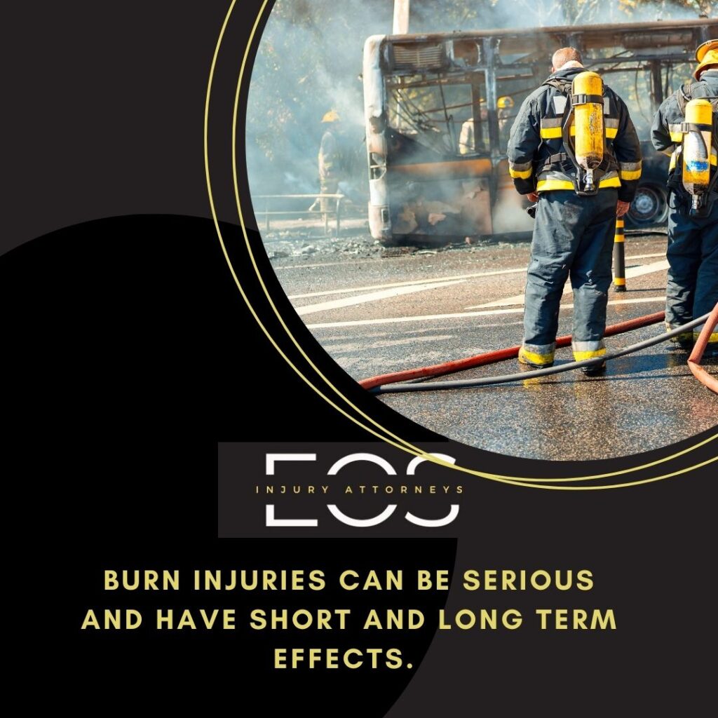 Burn Injuries Lawyer | Eos Law | Burn Injuries Lawyer Near Me